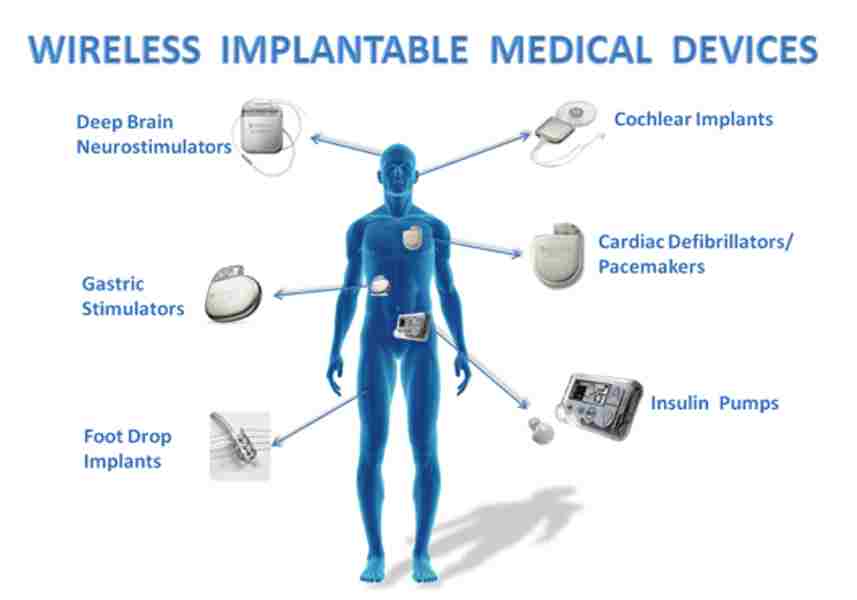 IoT implants for healthcare- 13angle.com