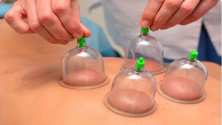 INTRODUCTION TO HIJAMA THERAPY OR CUPPING THERAPY- 13angle.com