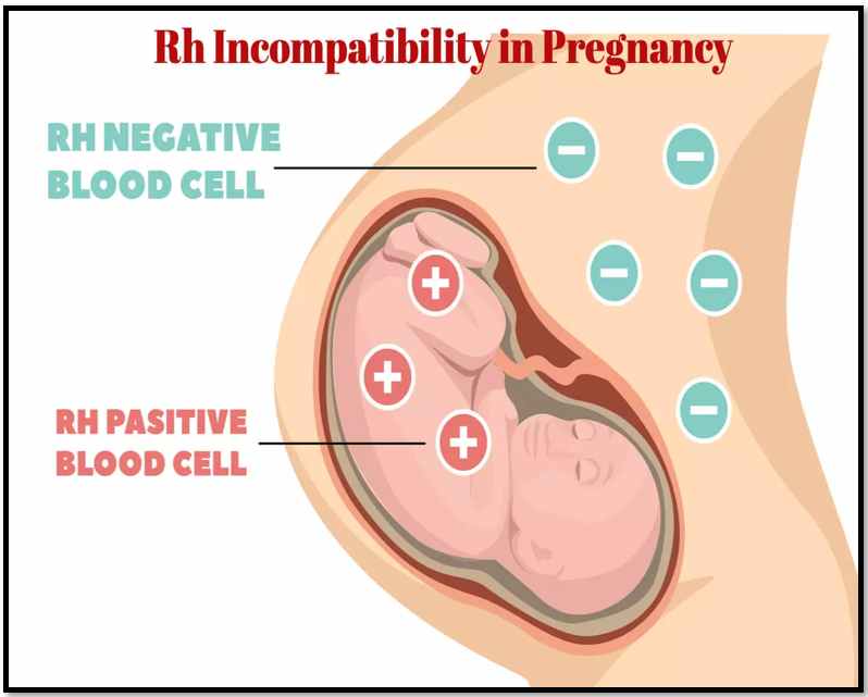 Identification of complications during pregnancy- 13angle.com