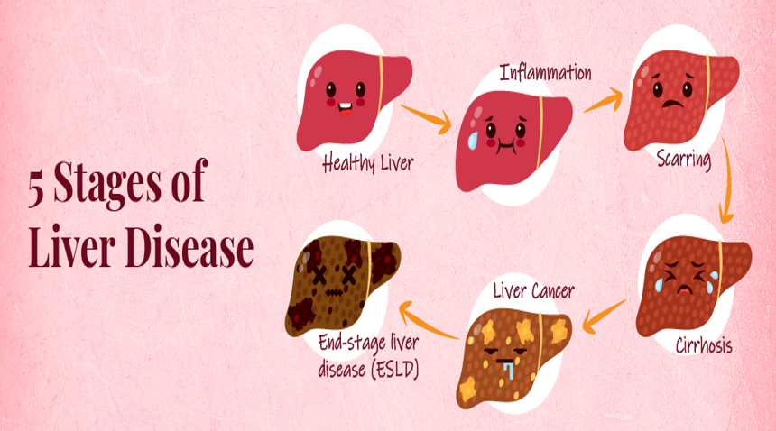 Liver- 13angle